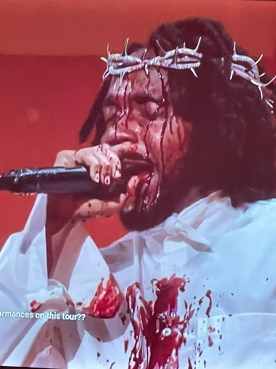 KL with blood running down his face wearing the Tiffany tiara